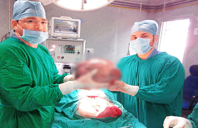 12kg_Tumor_from_Woman_Stomach_niharonline