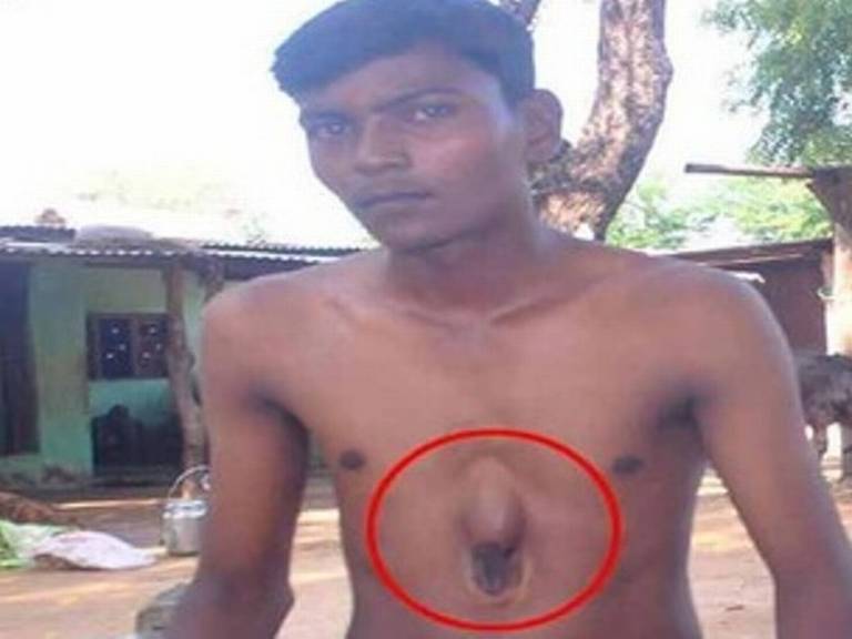 boy_heart_outside_of_body_niharonline