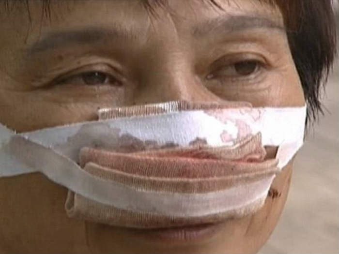 man_bites_wife_nose_china_niharonline